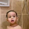 Kondisi Terbaru Gala