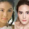 seleb cantik thailan diduga oplas