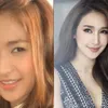 seleb cantik thailan diduga oplas
