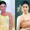 selebritis diduga oplas