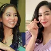 selebritis diduga oplas