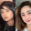 selebritis diduga oplas
