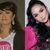 selebritis diduga oplas