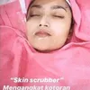 siti badriah, siti badriah filler bibir, pernikahan sitri badriah