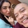 Anang Hermansyah tanam rambut di Turki