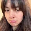 Aurelie Moeremans, cobaan pernikahan, kecelakaan mobil, dampak besar