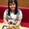 Chitra adik Choky Sitohang down syndrome