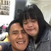 Chitra adik Choky Sitohang down syndrome