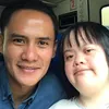 Chitra adik Choky Sitohang down syndrome