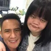 Chitra adik Choky Sitohang down syndrome
