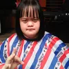 Chitra adik Choky Sitohang down syndrome