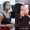 perbedaan Kirana Larasati dulu vs sekarang setelah oplas
