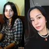 perbedaan Kirana Larasati dulu vs sekarang setelah oplas