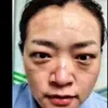 viral, berita viral, suster china, virus corona china
