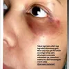 Selebgram Laras Permatasari Alami Kekerasan