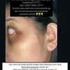 Selebgram Laras Permatasari Alami Kekerasan