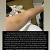 Selebgram Laras Permatasari Alami Kekerasan