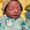 Anak Rizki DA demam