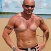 sunburn, bekas matahari, kelamaan berjemur, luka bakar kulit