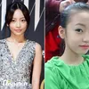Seleb Korea Operasi plastik