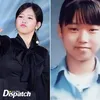 Seleb Korea Operasi plastik