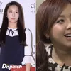 Seleb Korea Operasi plastik