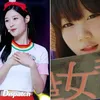 Seleb Korea Operasi plastik