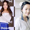 Seleb Korea Operasi plastik