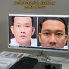 Denny Sumargo operasi kantong mata