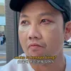 Denny Sumargo operasi kantong mata