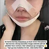 Mawar AFI Oplas di Korea