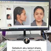 Mawar AFI Oplas di Korea