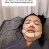 Mawar AFI Oplas di Korea