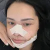 Mawar AFI Oplas di Korea