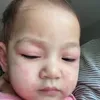 baby Numa anak Mona Ratuliu alami alergi
