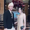 kevin aprilio, berita kevin aprilio, kevin aprilio transplantasi rambut