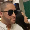 kevin aprilio, berita kevin aprilio, kevin aprilio transplantasi rambut