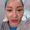 Lucinta Luna Permak Wajah