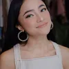 Marshanda Diet Makin Cantik Alami Oplas 