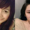 seleb oplas, seleb operasi plastik, hasil operasi plastik selebriti