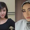 seleb oplas, seleb operasi plastik, hasil operasi plastik selebriti