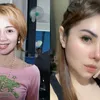 seleb oplas, seleb operasi plastik, hasil operasi plastik selebriti