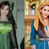seleb oplas, seleb operasi plastik, hasil operasi plastik selebriti