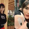seleb oplas, seleb operasi plastik, hasil operasi plastik selebriti