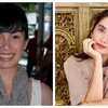 seleb tanam benang, perawatan seleb
