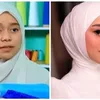 seleb tanam benang, perawatan seleb