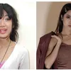 seleb tanam benang, perawatan seleb