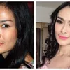 seleb tanam benang, perawatan seleb