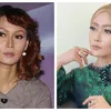 seleb tanam benang, perawatan seleb