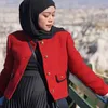 Selebriti cantik yang sedang hamil anak pertama